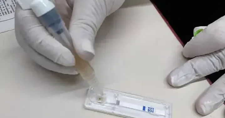 RIO NEGRO: Salud ofrece un test de detección de cáncer colorrectal de forma gratuita  El Ministerio de Salud provincial recuerda a todas las personas que tengan entre 50 y 75 años que se ofrece un test simple, rápido y sin costo en centros de salud y hospitales rionegrinos, en el marco de la campaña de prevención y detección temprana del cáncer colorrectal que se desarrolla todo junio. Este test es clave y busca concientizar a la población objetivo la importancia de los controles periódicos.