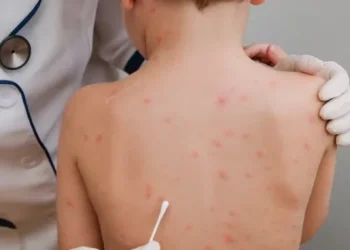 Con críticas a Nación, Provincia alerta por avance de otro brote de sarampión