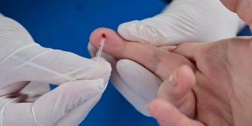 BAHIA BLANCA: ElegíSaber – Jornada de testeo HIV y Sífilis