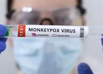 Detectaron el primer caso de viruela del mono de mayor severidad en la Argentina