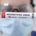 Detectaron el primer caso de viruela del mono de mayor severidad en la Argentina