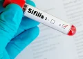 Sífilis en Argentina: cifras que baten récords y la estrategia de prevención ante una epidemia invisible