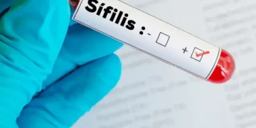 Sífilis en Argentina: cifras que baten récords y la estrategia de prevención ante una epidemia invisible