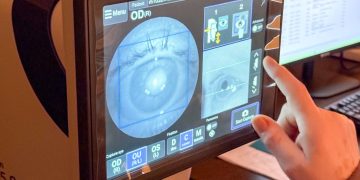TORNQUIST: Más de 100 personas de Tornquist con diabetes recibieron retinografías gratuitas