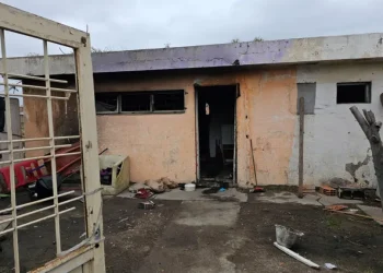 BAHIA BLANCA: Joven de 21 años fue atendida en el Hospital Municipal por quemaduras