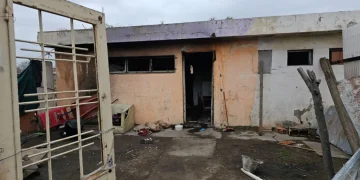 BAHIA BLANCA: Joven de 21 años fue atendida en el Hospital Municipal por quemaduras